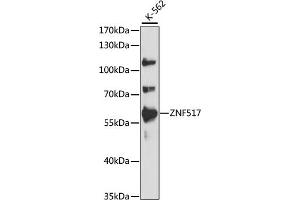 Western blot analysis of extracts of K-562 cells, using ZNF517 antibody (ABIN7271495) at 1:1000 dilution. (ZNF517 Antikörper  (AA 70-180))
