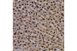Immunohistochemistry of paraffin-embedded rat lung using AHR Rabbit pAb (ABIN3015499, ABIN3015500, ABIN5663909 and ABIN6218543) at dilution of 1:100 (40x lens). (Aryl Hydrocarbon Receptor Antikörper  (AA 619-848))