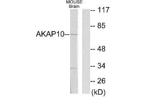 Western Blotting (WB) image for anti-A Kinase (PRKA) Anchor Protein 10 (AKAP10) (N-Term) antibody (ABIN1848976) (AKAP10 Antikörper  (N-Term))