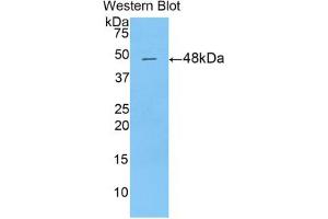 Western blot analysis of the recombinant protein. (Dermatopontin Antikörper  (AA 29-197))