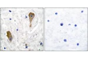 Immunohistochemistry analysis of paraffin-embedded human brain tissue, using GAD1 Antibody.