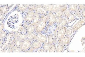 Immunohistochemistry (IHC) image for anti-Interleukin 1 Receptor Antagonist (IL1RN) (AA 24-174) antibody (ABIN7431368)