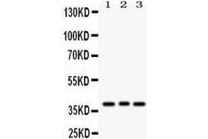Western Blotting (WB) image for anti-Wingless-Type MMTV Integration Site Family Member 2 (WNT2) (AA 56-81), (N-Term) antibody (ABIN3042336)