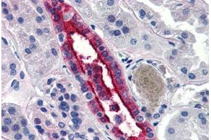 Human Kidney (formalin-fixed, paraffin-embedded) stained with AQP2 antibody ABIN290706 at 20 ug/ml followed by biotinylated goat anti-rabbit IgG secondary antibody ABIN481713, alkaline phosphatase-streptavidin and chromogen. (AQP2 Antikörper  (N-Term))