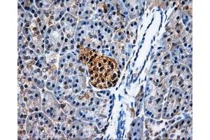 Immunohistochemical staining of paraffin-embedded Kidney tissue using anti-PSMC3mouse monoclonal antibody. (PSMC3 Antikörper)
