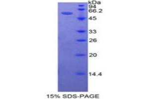 SDS-PAGE (SDS) image for Intercellular Adhesion Molecule 5 (ICAM5) (AA 409-674) protein (His tag,GST tag) (ABIN2123043) (ICAM5 Protein (AA 409-674) (His tag,GST tag))