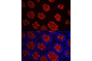 Immunofluorescence analysis of human colon carcinoma cells using MUC2 Rabbit pAb (ABIN7268690) at dilution of 1:50 (40x lens). (MUC2 Antikörper  (AA 4850-4950))