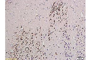 Formalin-fixed and paraffin embedded rat brain labeled with Anti-UCHL1/PGP9. (UCHL1 Antikörper  (AA 35-140))