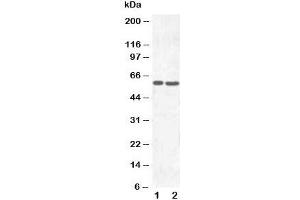 Western blot testing of SLC22A6 antibody and Lane 1:  HT1080;  2: HeLa cell lysate
