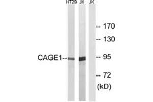 Western blot analysis of extracts from HT-29/Jurkat cells, using CAGE1 Antibody. (CAGE1 Antikörper  (AA 711-760))