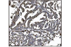 IHC analysis of FABP-1/GOT2 using anti-FABP-1/GOT2 antibody (ABIN7601426). (GOT2 Antikörper  (AA 35-430))
