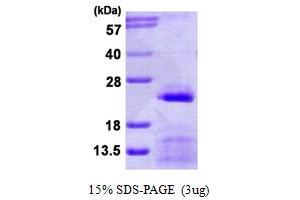 SDS-PAGE (SDS) image for Small Nuclear Ribonucleoprotein Polypeptide C (SNRPC) (AA 1-159) protein (His tag) (ABIN7279644) (SNRPC Protein (AA 1-159) (His tag))