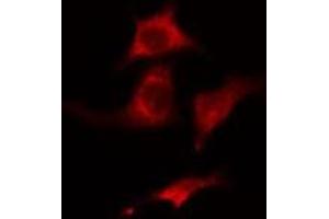ABIN6275440 staining HuvEc cells by IF/ICC. (Radixin Antikörper  (Internal Region))