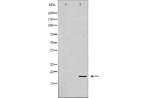 Western blot analysis of Hela whole cell lysates, using SKP1 Antibody. (SKP1 Antikörper  (Internal Region))