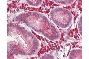 Human Small Intestine: Formalin-Fixed, Paraffin-Embedded (FFPE) (BCL3 Antikörper  (AA 2-13))