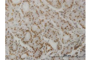 Immunostaining (ISt) image for anti-Protein Phosphatase 3, Catalytic Subunit, alpha Isoform (PPP3CA) (AA 1-84) antibody (ABIN519132)