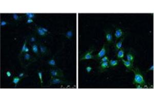 Immunofluorescence analysis of LC3B Antibody  in Rat brain before (left) and after (right) treatment with rapamycin (100 nm for 4 hr). (LC3B Antikörper  (N-Term))