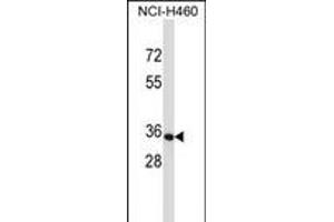 OR14C36 Antibody (C-term) (ABIN657683 and ABIN2846675) western blot analysis in NCI- cell line lysates (35 μg/lane). (OR14C36 Antikörper  (C-Term))