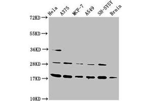 Western Blot Positive WB detected in: Hela whole cell lysate, A375 whole cell lysate, MCF-7 whole cell lysate, A549 whole cell lysate, SH-SY5Y whole cell lysate, Rat brain tissue All lanes: DAZAP2 antibody at 3. (DAZAP2 Antikörper  (AA 1-168))