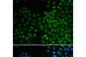 Immunofluorescence analysis of U2OS cells using NR0B2 Polyclonal Antibody (NR0B2 Antikörper)