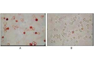 Immunocytochemistry analysis of TPA induced BCBL-1 cells (A) and uninduced BCBL-1 cells (B) using KSHV ORF62 mouse mAb with AEC staining.