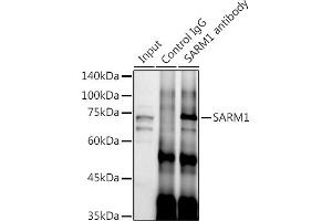 Immunoprecipitation analysis of 300 μg extracts of SH-SY5Y cells using 3 μg S antibody (ABIN7270591). (SARM1 Antikörper)