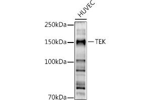 Western blot analysis of extracts of HUVEC cells, using TEK antibody (ABIN6127575, ABIN6148992, ABIN6148994 and ABIN6213973) at 1:500 dilution. (TEK Antikörper  (AA 500-750))