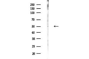Western blot analysis of lysates from HUVEC cells(starvation,24h treatment), using NR1I2 Antibody at 1/1000 dilution.