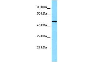 WB Suggested Anti-CLNK Antibody Titration: 1. (CLNK Antikörper  (C-Term))