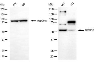 Western blotting analysis using SOX10 antibody (ABIN7800972). (Rekombinanter SRY-Box Transcription Factor 10 Antikörper)