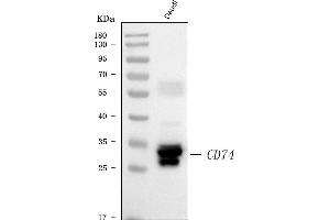 Western blot analysis of CD74 using anti-CD74 antibody (ABIN7602385). (CD74 Antikörper  (AA 73-296))