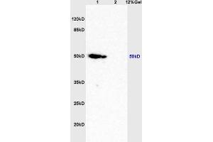 Lane 1: mouse brain lysates Lane 2: mouse lung lysates probed with Anti Caspase-9 p10 Polyclonal Antibody, Unconjugated (ABIN1387603) at 1:200 in 4 °C. (Caspase 9 Antikörper  (AA 351-416))