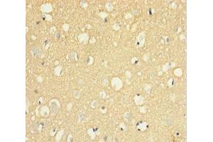 Immunohistochemistry of paraffin-embedded human brain tissue using ABIN7174125 at dilution of 1:100 (SIRPA Antikörper  (AA 31-373))