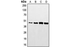 Western blot analysis of STAC2 expression in HeLa (A), mouse kidney (B), rat kidney (C), A431 (D) whole cell lysates. (STAC2 Antikörper  (Center))