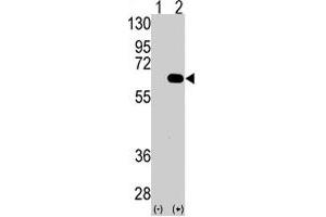 Western blot analysis of AMFR (arrow) using AMFR polyclonal antibody . (AMFR Antikörper  (AA 571-601))