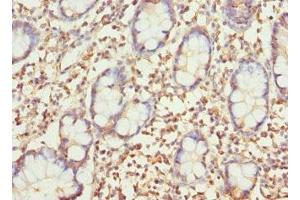 Immunohistochemistry of paraffin-embedded human small intestine tissue using ABIN7154604 at dilution of 1:100 (SAR1A Antikörper  (AA 1-198))