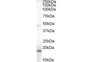 Western Blotting (WB) image for anti-Brain and Acute Leukemia, Cytoplasmic (BAALC) (AA 136-150) antibody (ABIN296188) (BAALC Antikörper  (AA 136-150))
