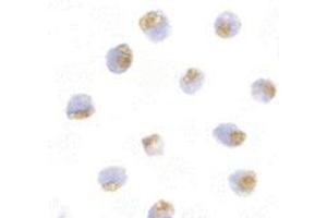 Immunocytochemistry of TLR1 in Daudi with this product at 10 μg/ml. (TLR1 Antikörper  (Center))