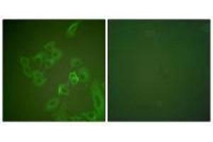 Immunofluorescence analysis of A549 cells, using Synuclein β antibody.