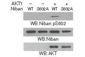 Western blot analysis in vitro kinase assays were performed by mixing purified bacterially expressed WT His-Niban or the His-Niban S602A with or without purified active AKT1 using Niban (Phospho-Ser602) Antibody. (Niban Antikörper  (pSer602))
