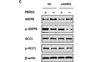 Acetyl-CoA carboxylase 1 (ACC1) activity is regulated by AMPK during PRRSV infection. (Acetyl-CoA Carboxylase alpha Antikörper  (pSer79))