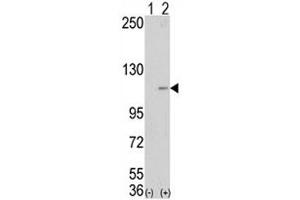 Western blot analysis of LSD1 antibody and 293 cell lysate (2 ug/lane) either nontransfected (Lane 1) or transiently transfected with the AOF2 gene (2). (LSD1 Antikörper  (AA 457-490))