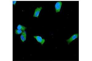 IF analysis of PGP9. (UCHL1 Antikörper  (C-Term))