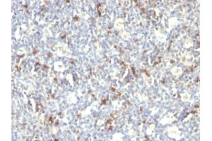 Formalin-fixed, paraffin-embedded human Spleen stained with CD57 Monoclonal Antibody (SPM129). (CD57 Antikörper)
