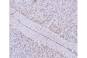 IHC analysis of FOXK1 using anti-FOXK1 antibody (ABIN7600295). (Foxk1 Antikörper  (AA 175-671))