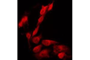 ABIN6266703 staining HeLa by IF/ICC. (PHF1 Antikörper  (Internal Region))