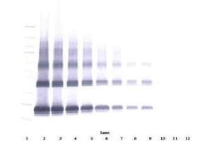 Image no. 2 for anti-Fibroblast Growth Factor 7 (FGF7) antibody (ABIN465624) (FGF7 Antikörper)
