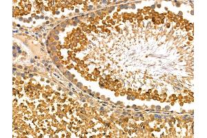 ABIN6259183 and ABIN6275173 at 1/100 staining Rat testis tissue by IHC-P. (SAR1B Antikörper  (Internal Region))