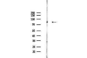 anti-Transglutaminase 7 (TGM7) antibody