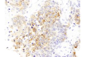 Immunohistochemistry (IHC) image for anti-Drebrin 1 (DBN1) (AA 599-649) antibody (ABIN7453432) (DBN1 Antikörper  (AA 599-649))